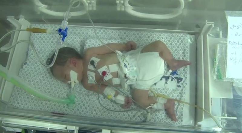 Parents experience miracle after docs say they've lost baby