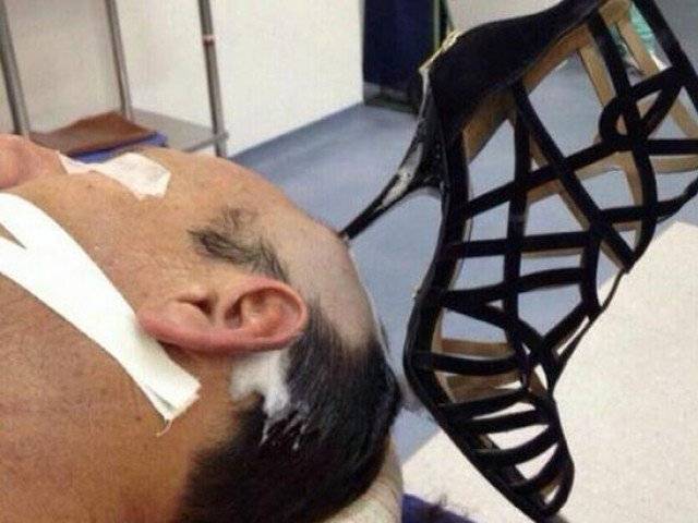STUCK IN MARRIAGE: Man hospitalised with shoe-heel in head