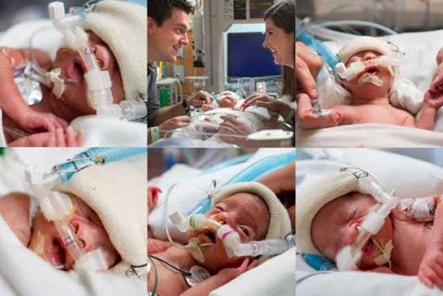 US woman gives birth to five girls in 4 minutes