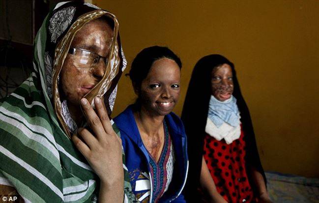 Free treatment for acid attack victims in Delhi, while Pakistan sleeps
