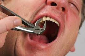 Saudi man dies while having tooth removed