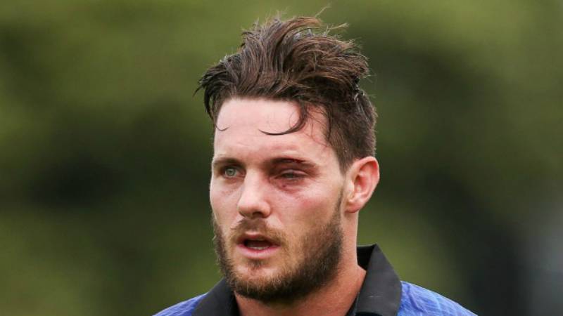 McClenaghan to undergo eye surgery after suffering facial fracture