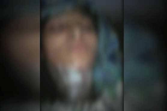 Girl burnt alive for rejecting marriage proposal in Murree dies in hospital