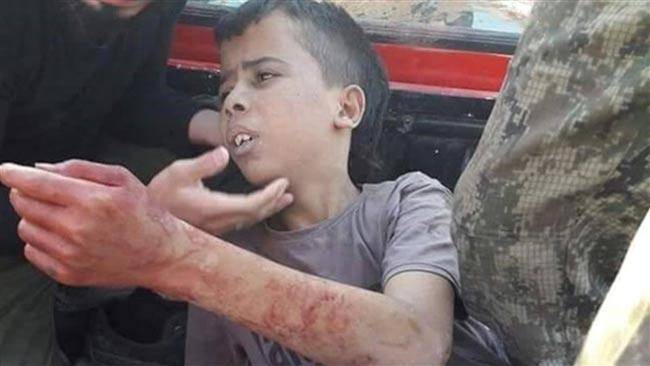 Shocking video shows US backed terrorists toying with brave young boy whose last wish was to be 