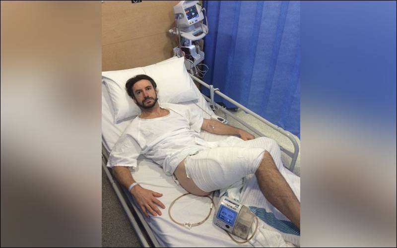 Melbourne man forced into surgery after iPhone explodes in his pocket