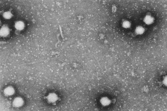 Congo virus claims another life in Quetta