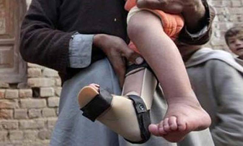 First Polio case of 2017 reported in southern Punjab