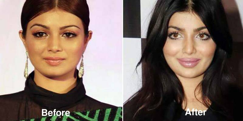 Ayesha Takia’s plastic surgery goes wrong and fans can’t handle it