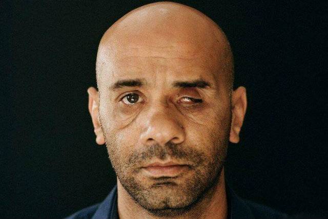Palestinian man, blinded by Israeli police, wins landmark case