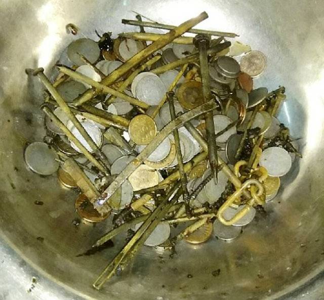 263 coins and 100 nails found in man’s stomach