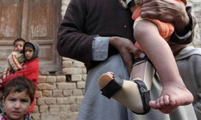 Second polio case surfaced in Karachi within 3 months
