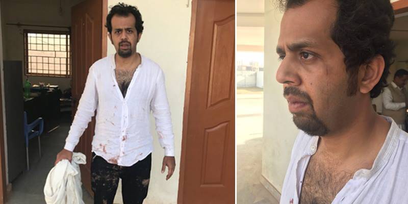 Journalist Taha Siddiqui narrowly escapes abduction bid, received beating in Islamabad