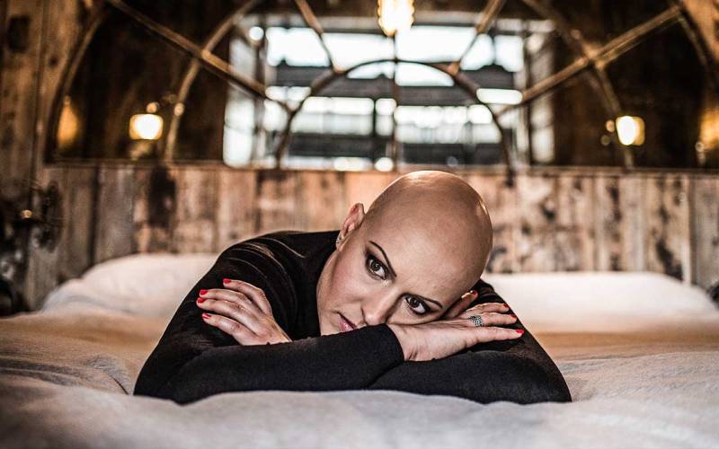 #Alopecia: Benidorm actress Sherrie Hewson shares experience of losing hair