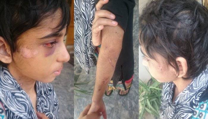 Child worker brutally tortured by Army major in Rawalpindi (VIDEO)