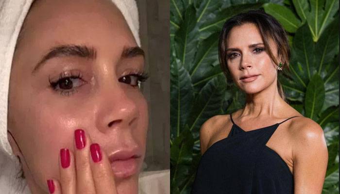Victoria Beckham uses moisturizer made from her own blood