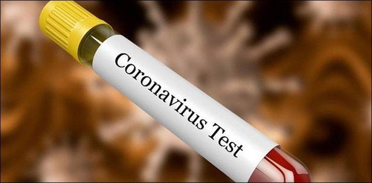 Random coronavirus tests to be conducted in Lahore