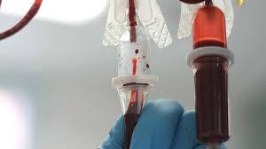 'Successful' plasma therapy trial on coronavirus patient in Hyderabad
