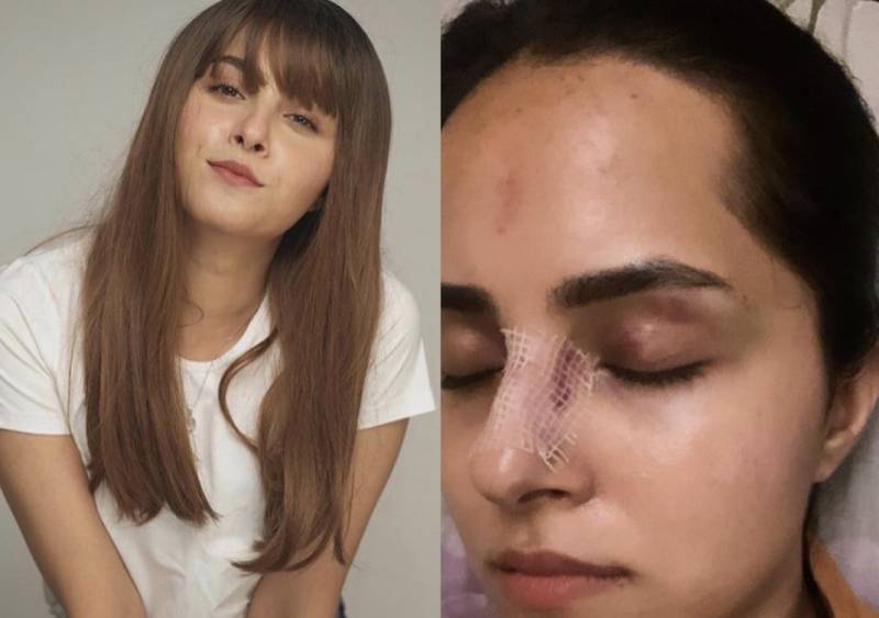 Nimra Khan injured after falling down the stairs 