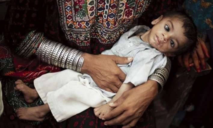 Four in 10 children are stunted in Pakistan: nutrition survey