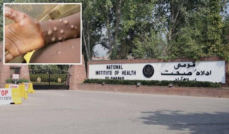 No monkeypox case detected in Pakistan, says top health body