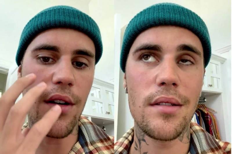 Justin Bieber takes break to recover from facial paralysis