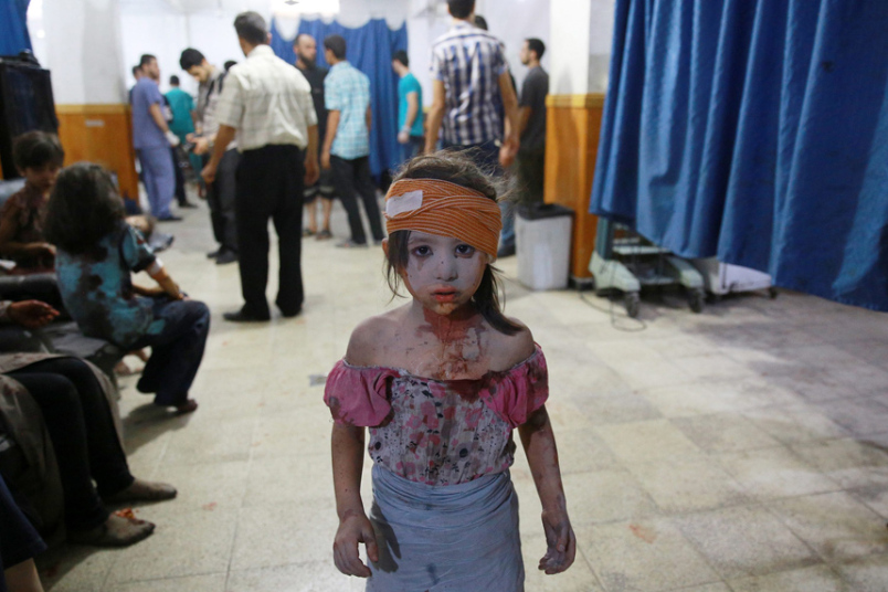 A wounded Syrian girl at a make shift hospital in the rebel-held area of Douma, east of the capital Damascus.–AFP