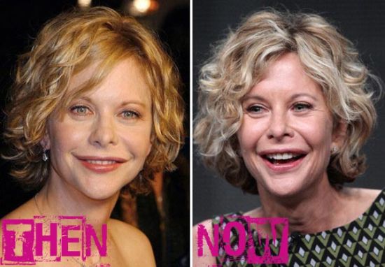 Meg Ryan'S New Face Overtakes Orlando Shooting In Global Twitter Trends