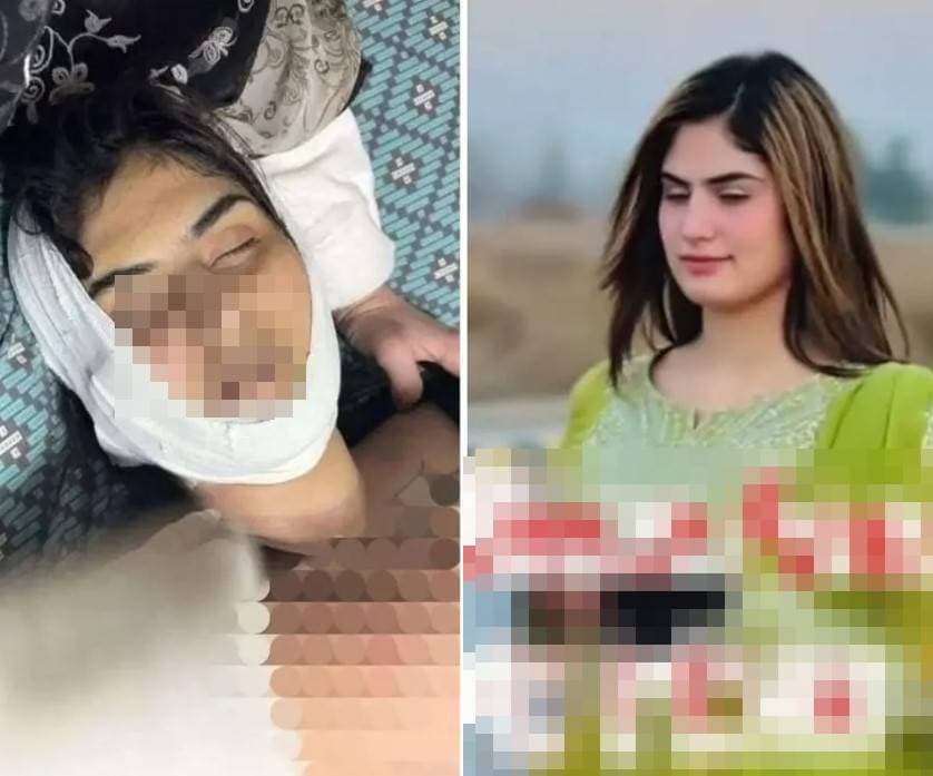 Who Was Syco Arbab Pakistani Tiktok Star Who Died By Suicide 