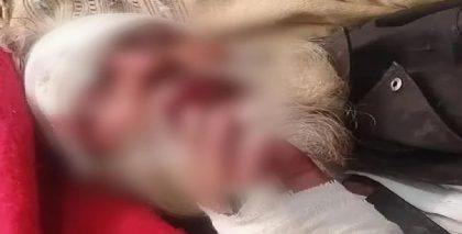 Elderly Man Brutally Tortured In Punjab While Son Watches Helplessly On Live Call From Malaysia