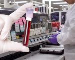 Gwada Negative New Blood Group Discovered In France In Rare Genetic Find