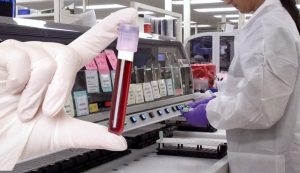 Gwada Negative New Blood Group Discovered In France In Rare Genetic Find