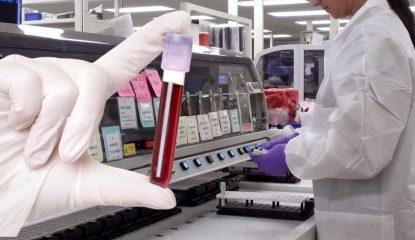 Gwada Negative New Blood Group Discovered In France In Rare Genetic Find