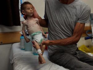 Gaza Baby Dies Of Hunger Along With 116 Amid Israeli Aid Site Shootings