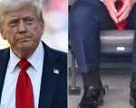Trump Suffering From Chronic Venous Insufficiency Says White House