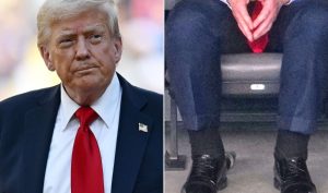 Trump Suffering From Chronic Venous Insufficiency Says White House