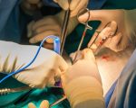 Police Bust Illegal Organ Transplant Gang In Rawalpindi