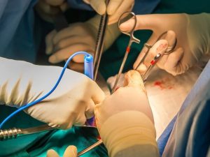 Police Bust Illegal Organ Transplant Gang In Rawalpindi