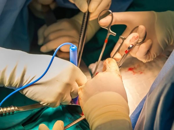 Police Bust Illegal Organ Transplant Gang In Rawalpindi