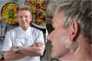 Celebrity Chef Gordon Ramsay Undergoes Emergency Cancer Treatment