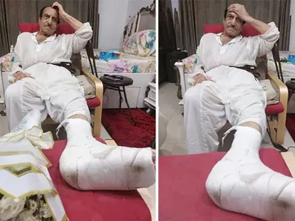 Mustafa Qureshi Suffers Leg Fracture Amid Poor Road Conditions In Karachi