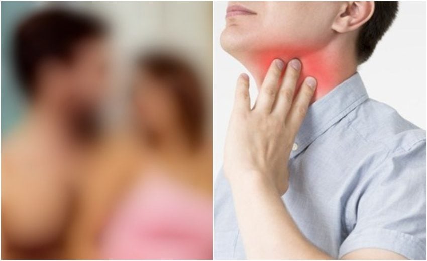 Oral Sex More Dangerous Than Smoking For Throat Cancer Experts Warn