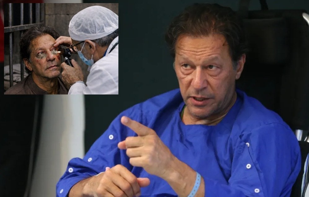 Imran Khan’s Vision Loss report FALSE as Top Doctors Share Eye Health Update