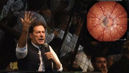 Medical Report Shows Imran Khan Suffered Severe Eye Damage In Jail