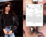 Model Iqra Nasir Siddiqui Alleges Physical Assault By Ex Husband