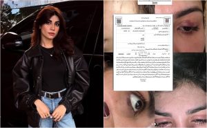 Model Iqra Nasir Siddiqui Alleges Physical Assault By Ex Husband