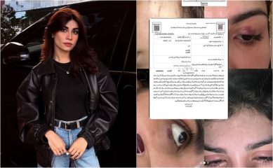 Model Iqra Nasir Siddiqui Alleges Physical Assault By Ex Husband