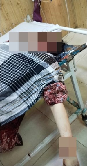 Ex Ambassador Ayaz Wazirs Daughter Dies In High Speed Crash Near Islamabads Parade Ground 