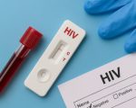 Hiv Screening To Be Made Mandatory Before Any Surgery Health Minister
