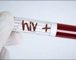 Pakistan To Launch Large Scale Hiv Screening In This Karachi Area Amid Outbreak