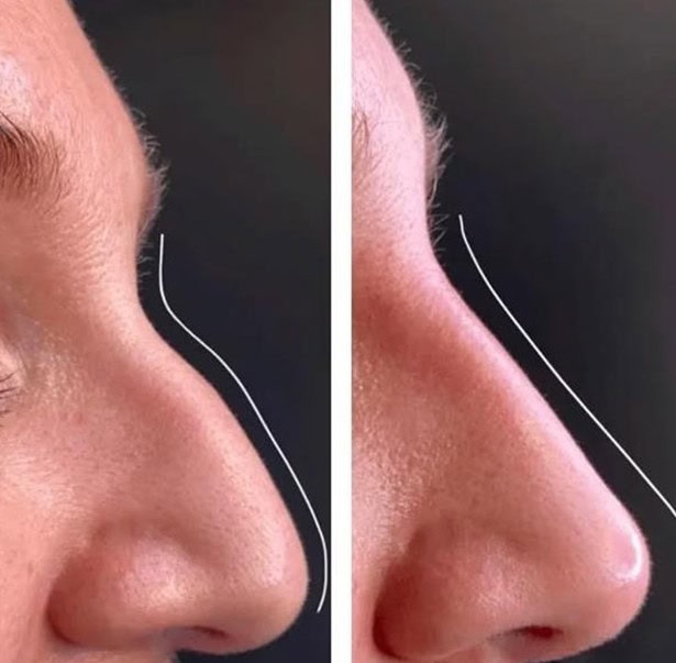 Why Are More Patients Choosing Enfield Royal Clinics For Cosmetic Surgery
